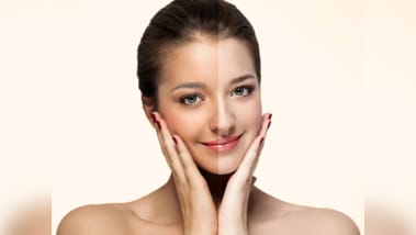 tanning caused by sun