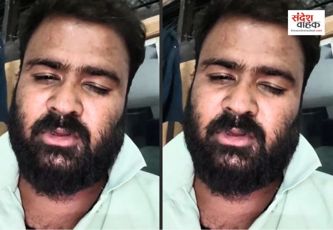 Moradabad News: शादी से पहले किसी और के साथ भागी मंगेतर, होने वाले पति ने जहर खाकर की आत्महत्या 