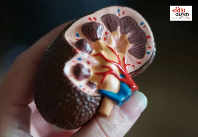 Kidney