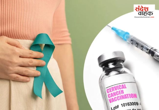 Cervical Cancer