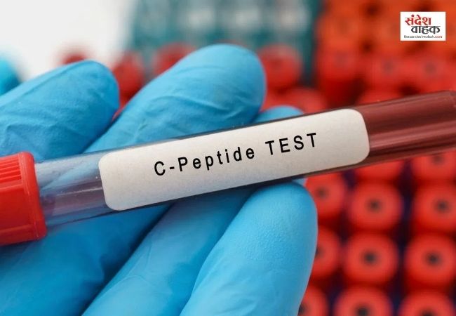 डायबिटीज के मरीजों के लिए बेहद जरूरी है C-Peptide टेस्ट