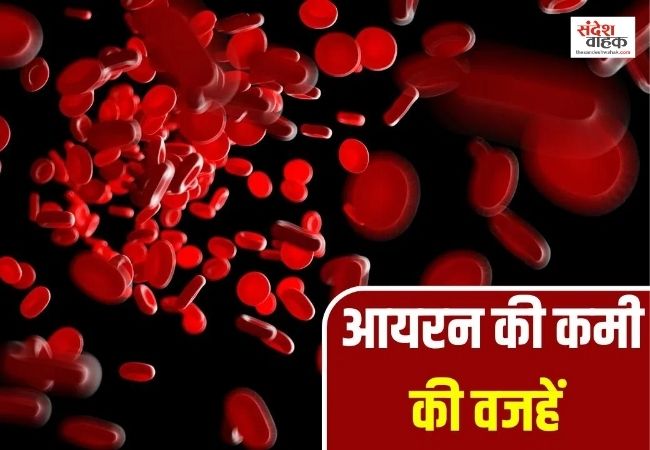 महिलाओं में क्यों होने लगती है Iron की कमी?