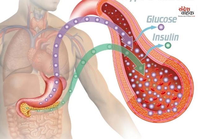 परहेज के बाद भी बढ़ जाती है Sugar, जानें क्या है इसकी असली वजह