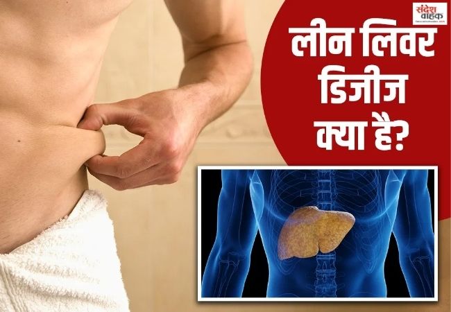 पतले लोगों में भी बढ़ रहा Fatty Liver का खतरा