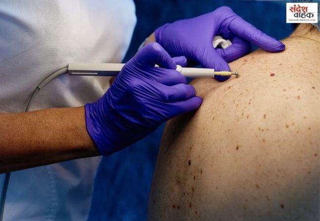 कहीं इस बीमारी का संकेत तो नहीं बार-बार होने वाला Skin Infection?