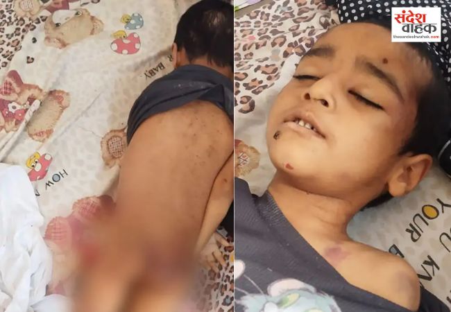 Lucknow News: चार साल के मासूम की संदिग्ध मौत, वकील पिता और सौतेली मां निर्मम हत्या का आरोप