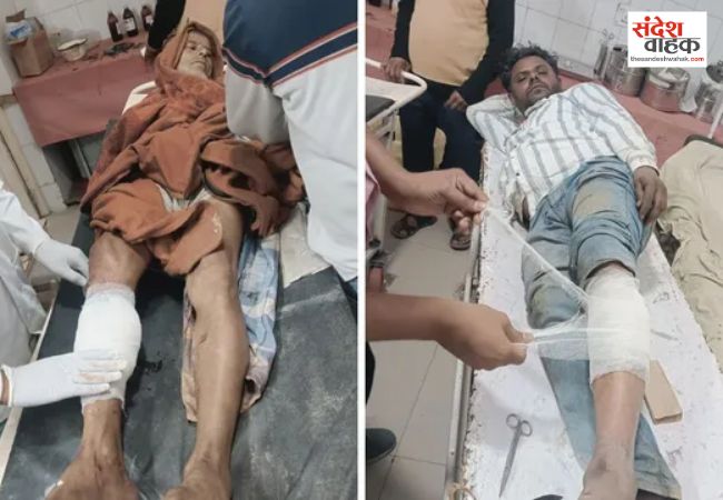 Moradabad News: पुलिस और गो-तस्करों के बीच मुठभेड़, दो बदमाशों के पैर में लगी गोली