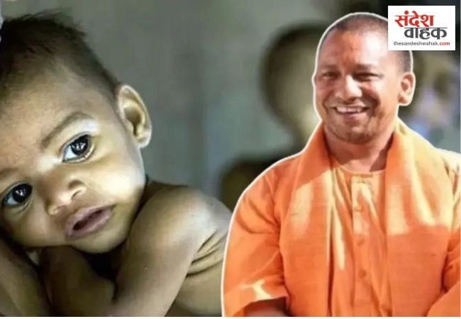 कुपोषण के खिलाफ जीवनरक्षक ढाल बना योगी सरकार का ‘संभव अभियान