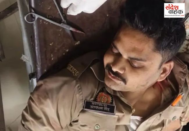 आरोपी को पकड़ने के लिए सिपाही ने ट्रैक पर लगाई दौड़, ट्रेन की चपेट में आने से कटा पैर