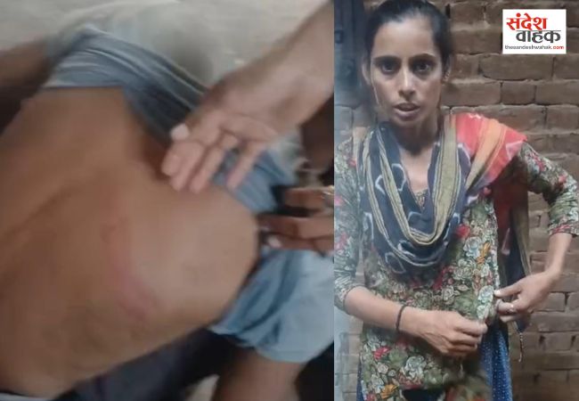 अलीनगर में दबंगों का तांडव, घर में घुसकर लाठी-डंडों से जानलेवा हमला