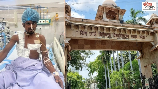 KGMU का कमाल! शरीर में धंसी 4 सरियों के साथ पहुंचा मजदूर, 8 घंटे 40 मिनट की सर्जरी से बची जान