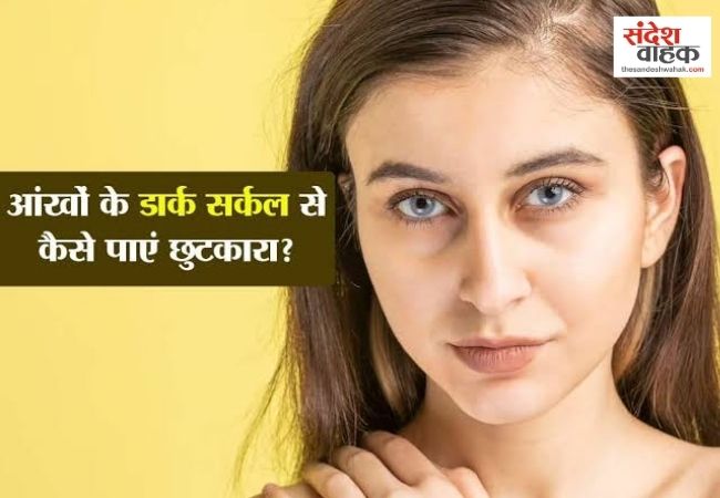 Dark Circles: बिना मेकअप काले घेरों को कम दिखाने के 9 आसान तरीके, जानें कैसे