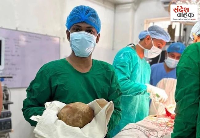 55 साल के शख्स के ब्लैडर से निकली 3.1 किलो की पथरी, डॉक्टर भी रह गए हैरान