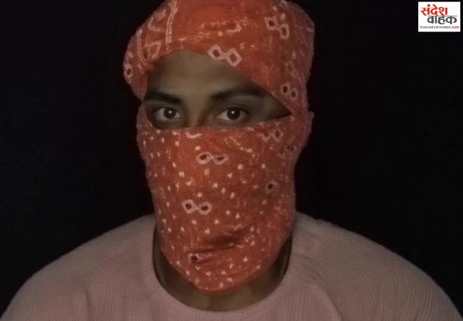 छात्रा से बदसलूकी करने का मुख्य आरोपी नंदन यादव पुलिस एनकाउंटर में घायल