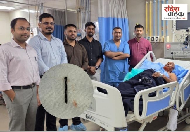 सीने में 11 साल से फंसी थी ड्रिल बिट, SGPGI के डॉक्टरों ने जटिल ऑपरेशन कर निकाली