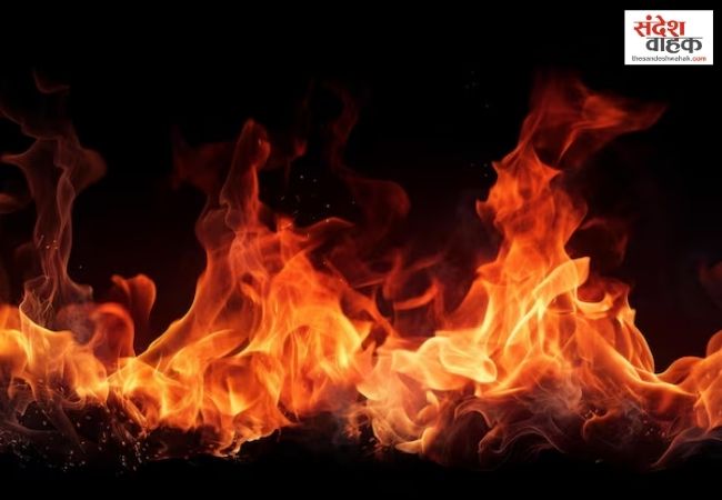 पीलीभीत में 62 हजार रुपये मजदूरी मांगी तो भड़का ठेकेदार, डीजल डालकर मजदूर को जलाया