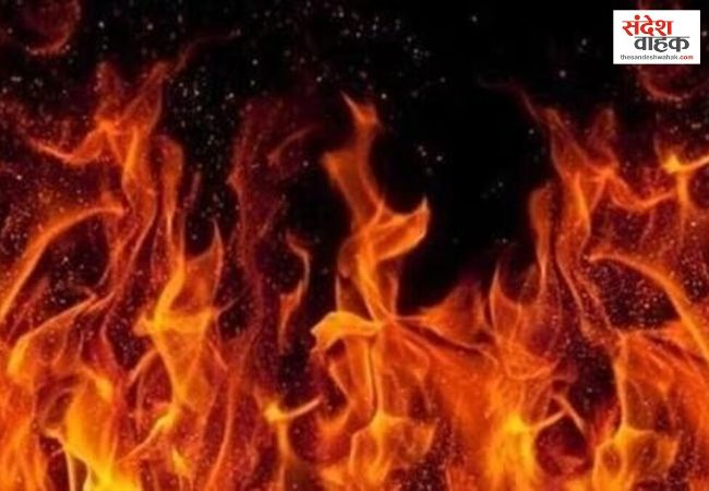 अलीगढ़ में संपत्ति विवाद में जेठ-जेठानी ने महिला पर पेट्रोल डालकर जिंदा जलाया, हालत गंभीर