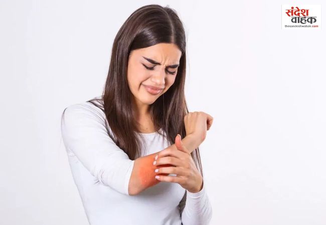 बार-बार होती है खुजली और त्वचा पर पपड़ी? एक्जिमा-सोरायसिस में जानें अंतर